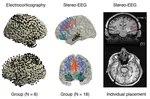 Human Intracranial Cognitive Neurophysiology
