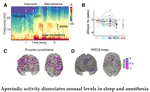 How can I run sleep and anesthesia studies with intracranial EEG?